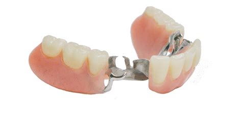 Maxillary Partial Denture Design