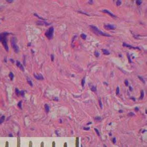 Photomicrographs Of Cross Section In Mid Portion Of Nerve Conduit At 2