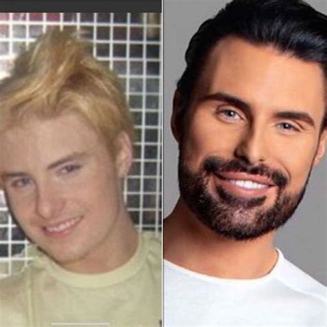 Rylan Clark-Neal teeth: Before and after pictures of X Factor’s veneers worth £25k | Express.co.uk