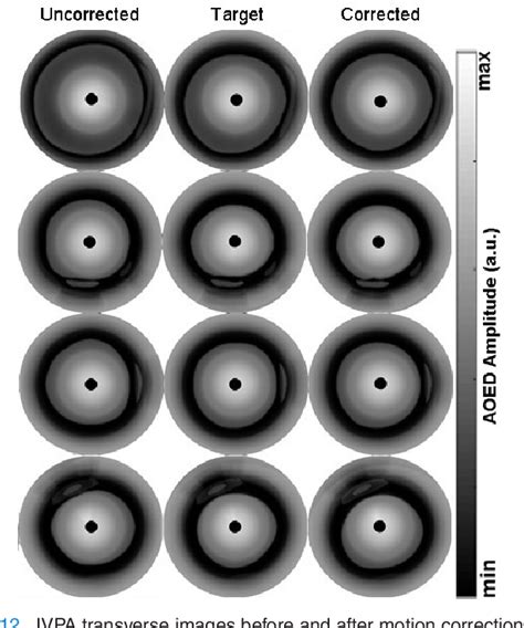 Figure 12 From A Deep Learning Method For Motion Artifact Correction In