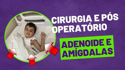 Cirurgia Adenoide E Am Gdalas E P S Operat Rio Alimenta O E Cuidados