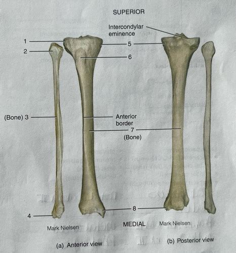 Anatomy Right Tibia Fibula And Patella Bone Structure Flashcards