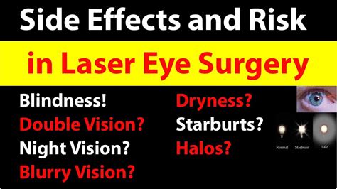 Side Effects Of Lasik Laser Eye Surgery Risk In Laser Eye Surgery Youtube