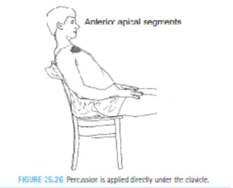 Postural Drainage Positions Flashcards Quizlet