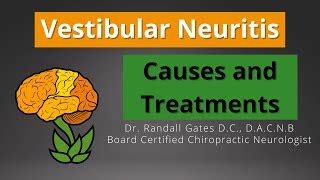 Vestibular Neuritis: Causes and Treatment | Doovi