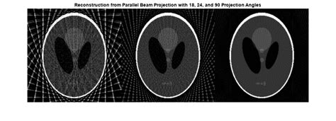 Cone Beam Reconstruction Using Matlab The Best Picture Of Beam