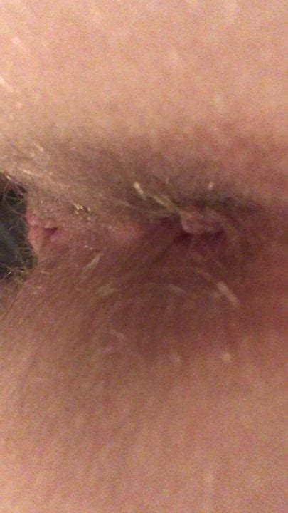 Ass My Wife Milf Anal Hairy Blonde Free Porn Xhamster Xhamster