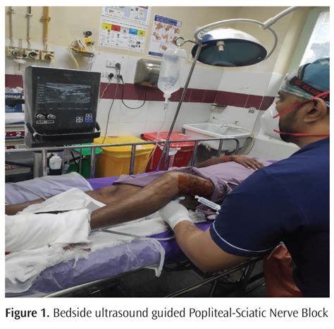 One Man Below Knee Analgesia In The Emergency Department With Minimal