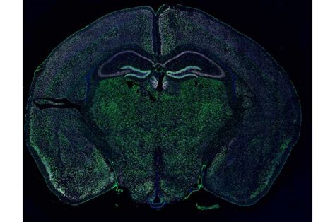 Researchers discover how some brain cells transfer material to neurons ...