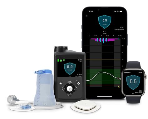 Simplera Sync Cgm A Promising Upgrade For Medtronic G Users