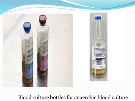 Anaerobic Culture Methods