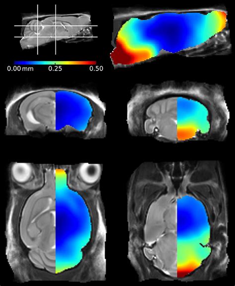 Frontiers Comparison Of In Vivo And Ex Vivo MRI For The Detection Of