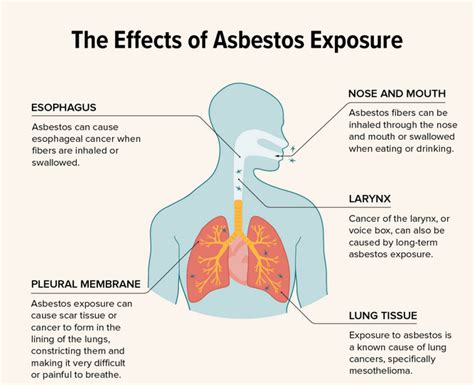 Asbestos Exposure Health Effects Risks Symptoms 2025