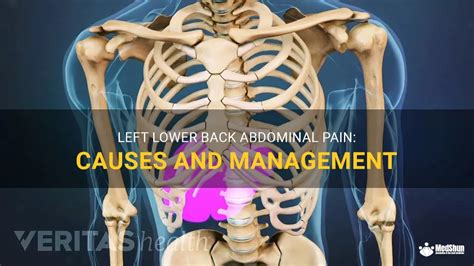 Left Lower Back Abdominal Pain: Causes And Management | MedShun