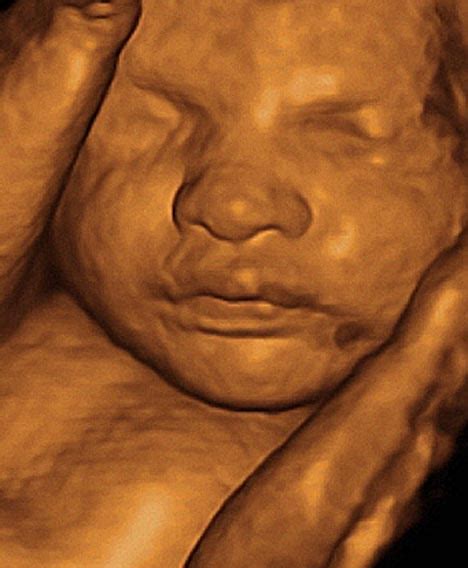 raymond davis blog: 3d ultrasound images at 28 weeks