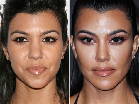 Kourtney Kardashian Nose Job Before And After