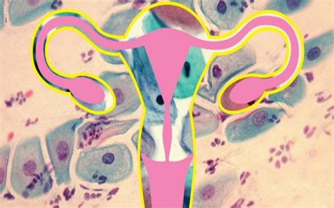 What Happens When Pap Smear Is Abnormal