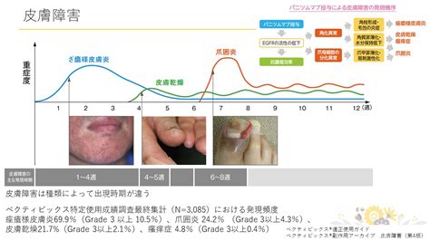 令和4年度 第1回 薬薬連携を充実させるための研修会 開催報告 国立がん研究センター 中央病院