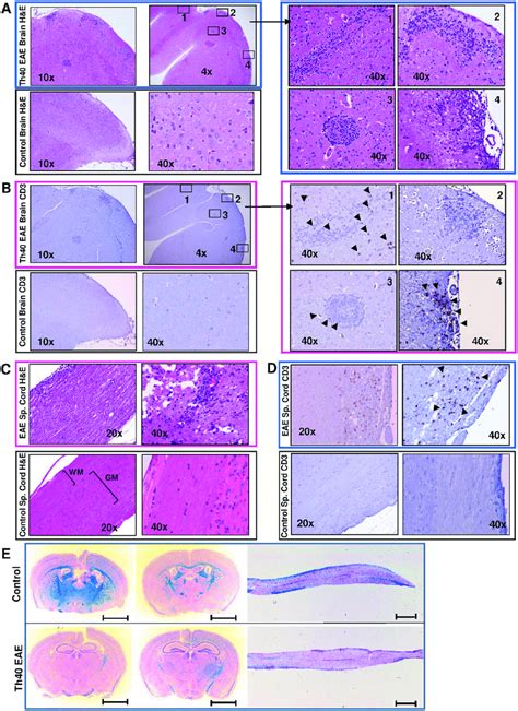 Th Cells Infiltrate Brain And Spinal Cord In Eae Disease Transfer