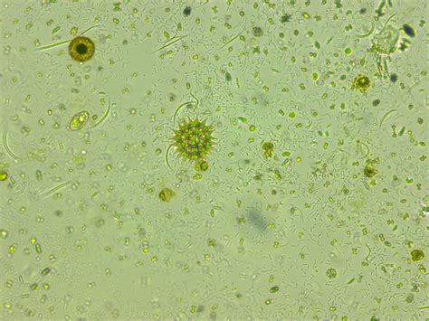 Phytoplankton 2 Image Eurekalert Science News Releases