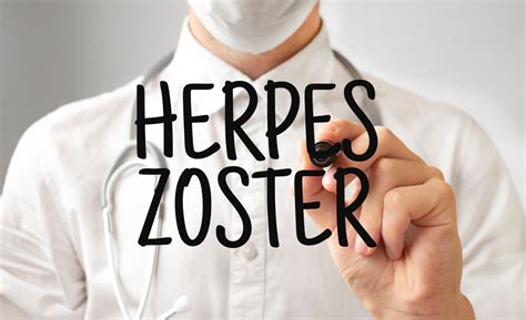 Herpes Zoster Virus Preno Enje Zaraznost Simptomi Posledice The Hot