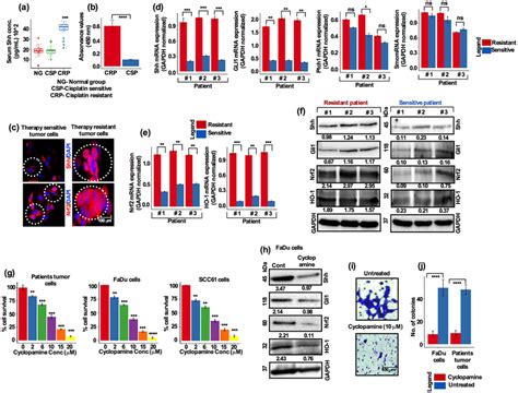 Shh And Nrf Are Highly Expressed In Treatment Resistant Hnscc Patient