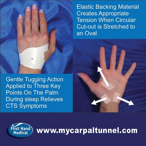 How To Stop Carpal Tunnel Pain Without Surgery | My Carpal Tunnel