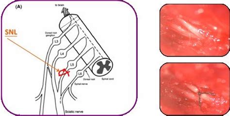 Spinal Nerve Ligation On The Exposed Lumbar L Nerve Trunk