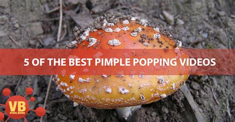 5 Of The Best Pimple Popping Videos, ViralBoro Web Stories