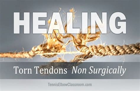 Can You Heal A Torn Tendon Non Surgically? (Golfer's Or Tennis Elbow)