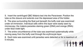 QBC ELISA Test PPT