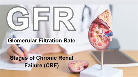 What is GFR? | Glomerular Filtration Rate | Stages of Chronic Kidney ...