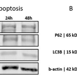 Western Blot Analysis Of The Apoptosis And Autophagy Biomarkers In