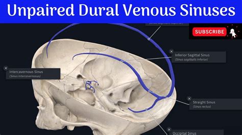 Dural Venous Sinus Gas