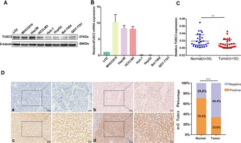 The Expression Of TUSC3 In HCC The Protein A And MRNA B Levels Of