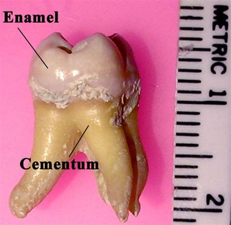 tooth enamel wikipedia