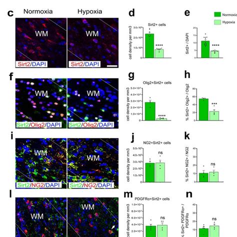 Hx Reduces Sirt Expression In Mature Wm Ols A Representative Western