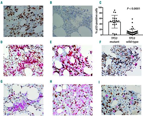 TP53 immunohistochemistry correlates with TP53 mutation status and ...