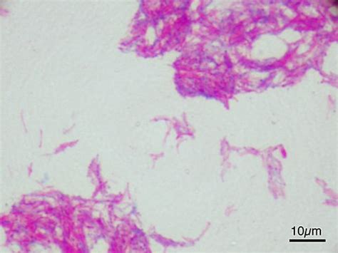 Mycobacterium Bovis