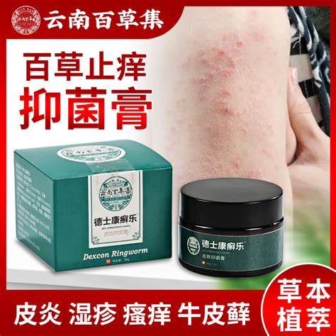 治牛皮廯银屑病止痒抑菌外用皮肤股藓湿疹专用藓痒专用癣药膏苗家 虎窝淘