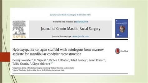 “pass” Principles For Predictable Bone Regeneration