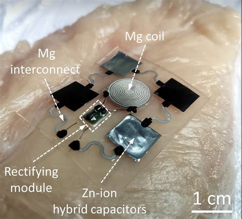 Scientists Invent Dissolving Implantable Supercapacitor The Register