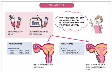 胚移植しても妊娠が成立しない… そのときには、prp治療を 選択肢の1つに！ 【英ウィメンズクリニック さんのみや 岡本恵理 先生】 不妊