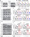 JCI TIMP2 Ameliorates Blood Brain Barrier Disruption In Traumatic