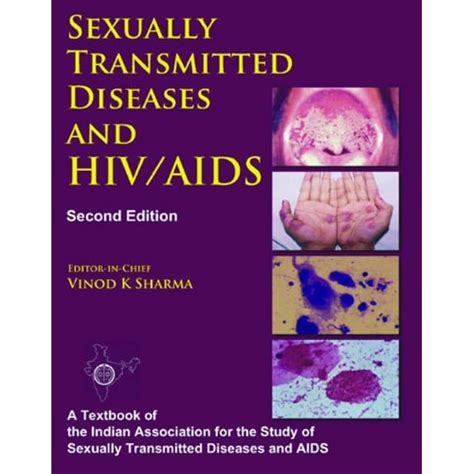 Sexually Transmitted Diseases And Hiv Aids Inspire Uplift