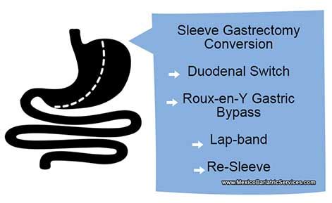 Revision Bariatric Surgery in Mexico - Cost & Options 