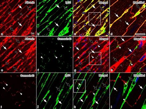 Confocal Laser Scanning Micrographs Of Double Immunofluorescence