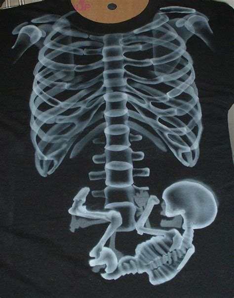 Pregnant X Ray T Shirt By Marquisdezod On Deviantart