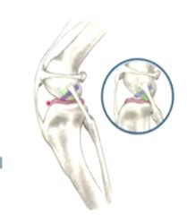 Surgery Exam Cranial Cruciate I Quizlet