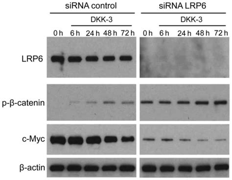 Exogenous DKK3 REIC inhibits Wnt βcatenin signaling and cell